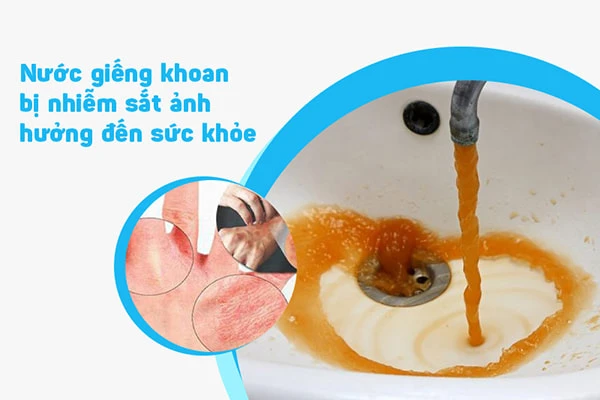 Nước Giếng Khoan Nhiễm Sắt Có Tác Hại Gì? Cách Xử Lý Như Thế Nào?